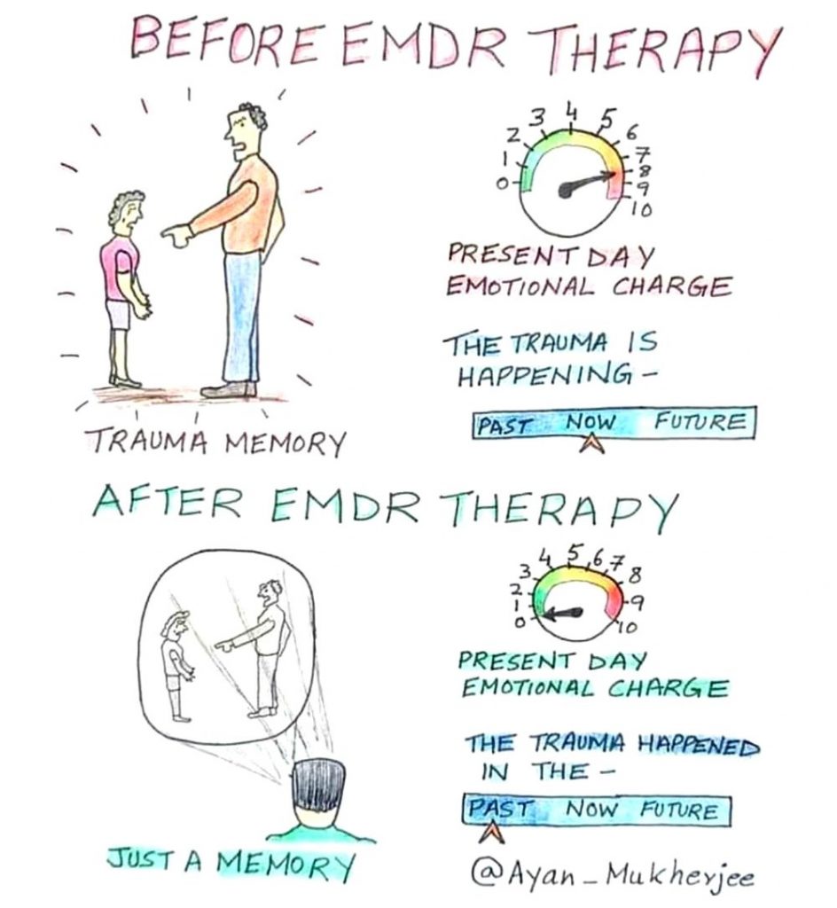 What Is EMDR Therapy? - Kells Counselling